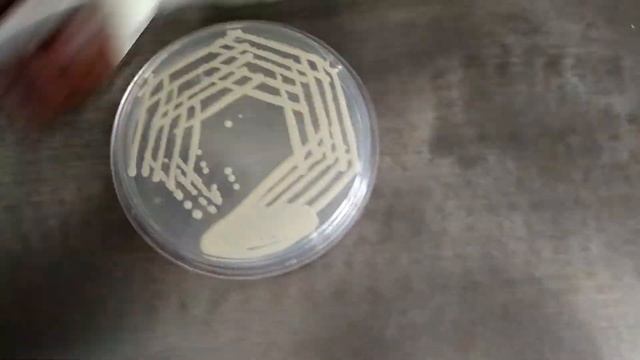 Candida and Cryptococcus Colony Morphology on Sabouraud dextrose agar (SDA) Demonstration смотреть онлайн