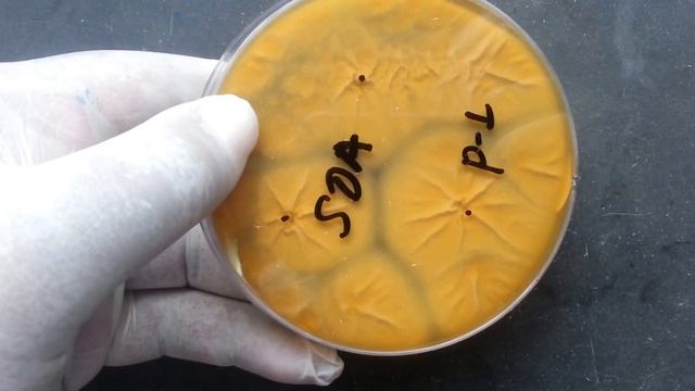 penicillium growth on SDA смотреть онлайн