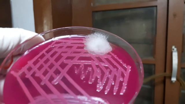 Bacteria and Fungus colony morphology Demonstration
