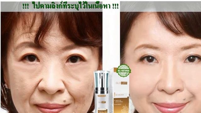 GloLift ราคา смотреть онлайн