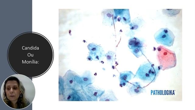 Agentes Etiológicos do Trato Genital Feminino смотреть онлайн