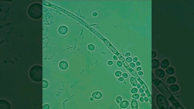 Candida albicans microscope and morphology 🤍🔬 смотреть онлайн