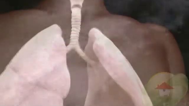 Rhizopus species смотреть онлайн