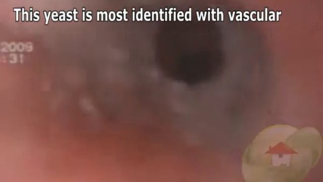 Candida lipolytica смотреть онлайн