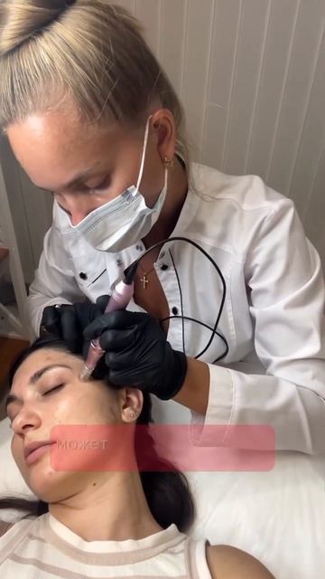 Как ускорить рост бровей и сделать их более густыми? Фракционная мезотерапия | Анастасия Ларина