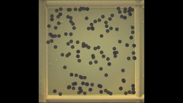 Counting Fusarium TR4 spores with Kova Glasstic slides смотреть онлайн