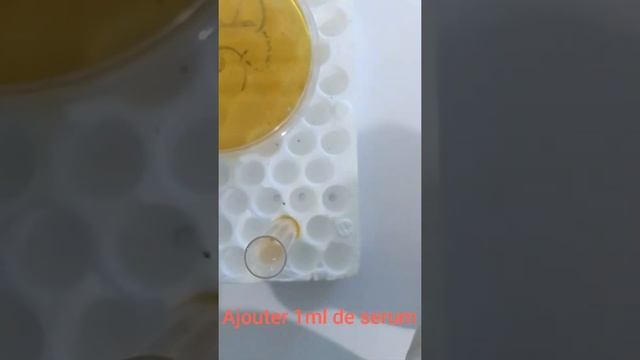 sérum tube identification of candida albicans. test de blastése ou test de filamentation. смотреть онлайн