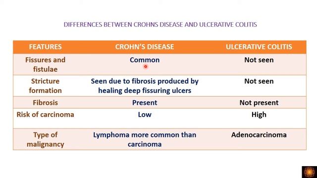 DIFFERENCES BETWEEN CROHNS DISEASE ULCERATIVE COLITIS AND INVESTIGATIONS IN IBD - By Dr.V.Shanthi