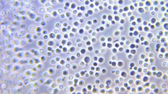 Candida albicans under phase contrast microscope смотреть онлайн