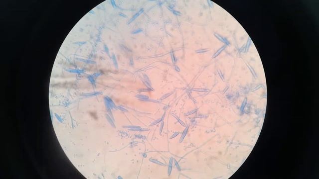 Trichophyton species on LPCB preparation смотреть онлайн