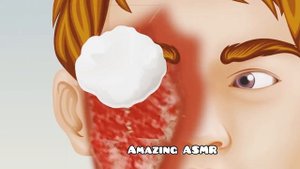 ASMR remove dogticks and worms from infected face | Deep cleaning anination