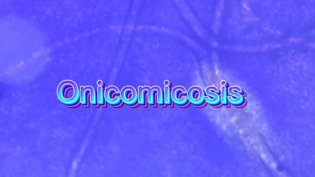 Toma de muestra de hongos del género Malassezia: biota normal, pitiriasis versicolor y onicomicosis