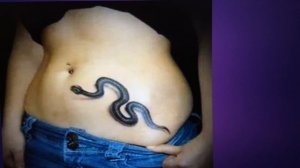 Живая змея в животе?!!