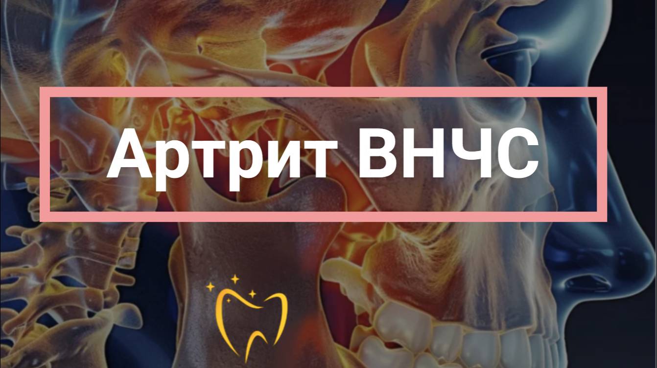 💥Артрит ВНЧС: что это и как понять, что пора на диагностику?