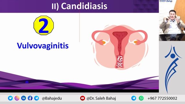 15. Candidiasis смотреть онлайн