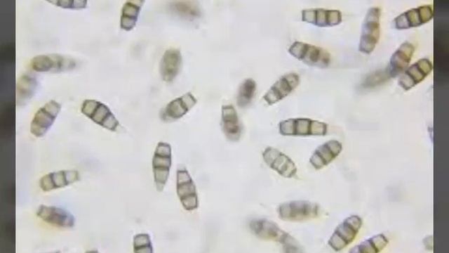 Pestalotiopisis Microspora | Harmful to Plastic | Eco friendly | Save Nature 🌱🌴