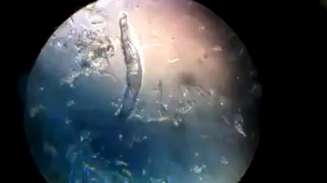 Demodex canis смотреть онлайн