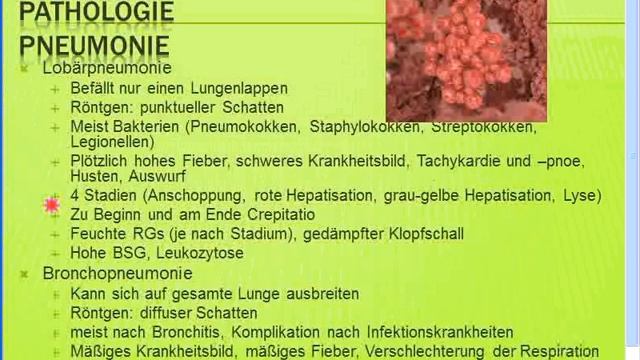 Gratis Seminar Pneumonien - Typische + atypische Pneumonien смотреть онлайн