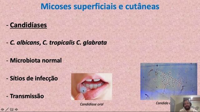 Fungos e micoses Humanas смотреть онлайн