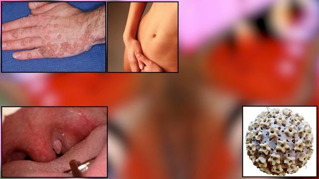 10 MALADIES de la  PEAU expliquées смотреть онлайн