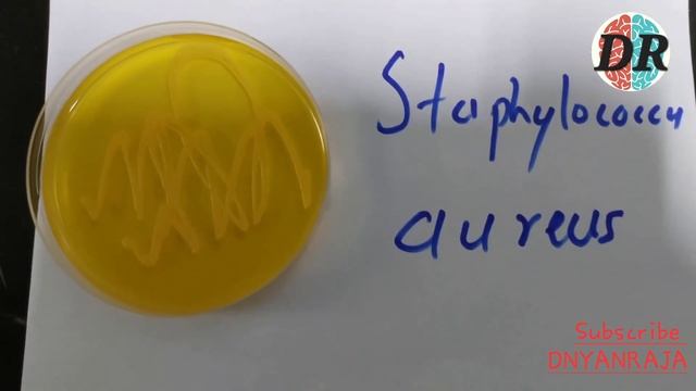 ESCHERICHIA COLI, PSEDOMONAS AERUGINOSA, STAPHYLOCOCCUS AUREUS AND CANDIDA ALBICANS смотреть онлайн