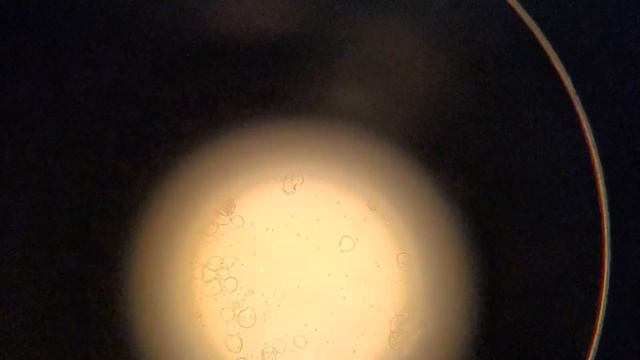 Batrachochytrium dendrobatidis