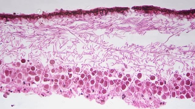 Lichen section under microscope 400x against bright field for education and experiments смотреть онлайн