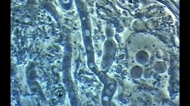 Oral Yeast смотреть онлайн