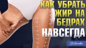 Как убрать жир с зоны галифе и ушки на бедрах? Липосакция галифе!