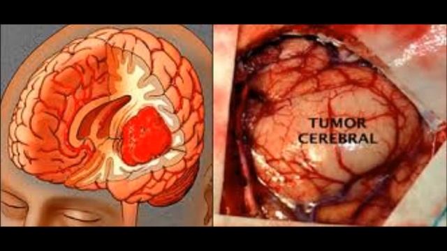 Aspartamo(E951) смотреть онлайн