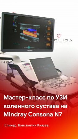 Мастер-класс по УЗИ коленного сустава на Mindray Consona N7