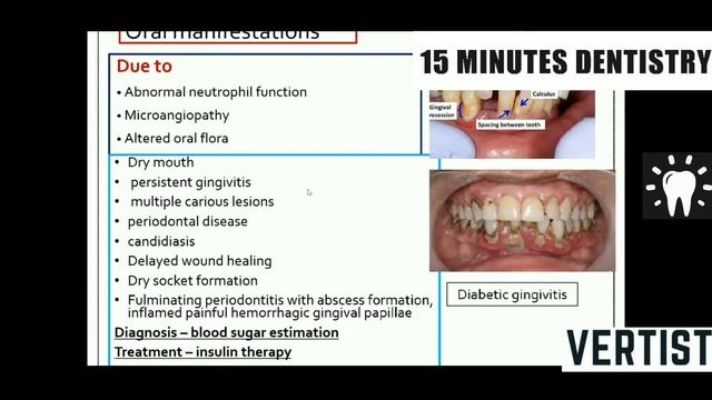 Type of Aphthous Ulcer  Disturbance in Mineral  Vitamin  Protein  Carbohydrates  Lipid