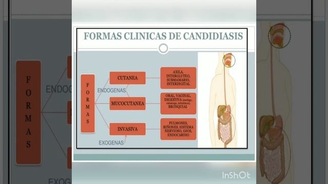 candida albicans E T  G6 смотреть онлайн