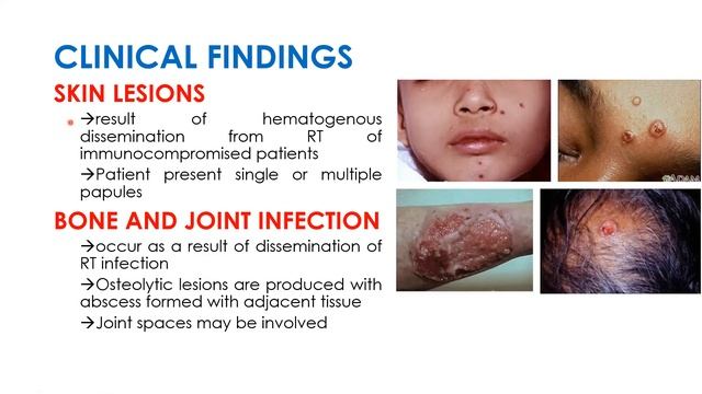 MYCOVIRO LEC (03-17-2021) смотреть онлайн
