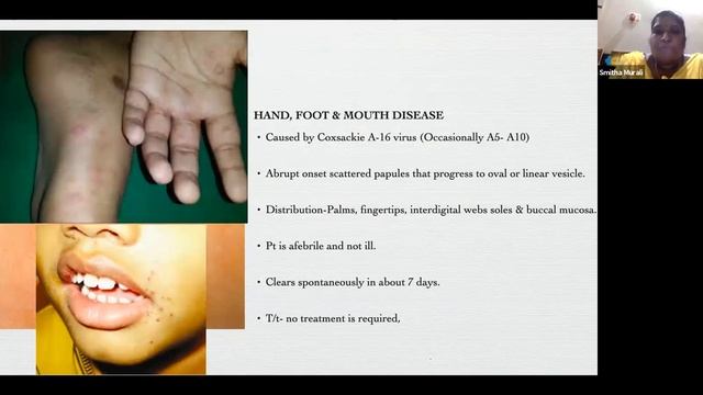 Common Dermatosis in Pediatric OP Practice - IAP Webinar смотреть онлайн