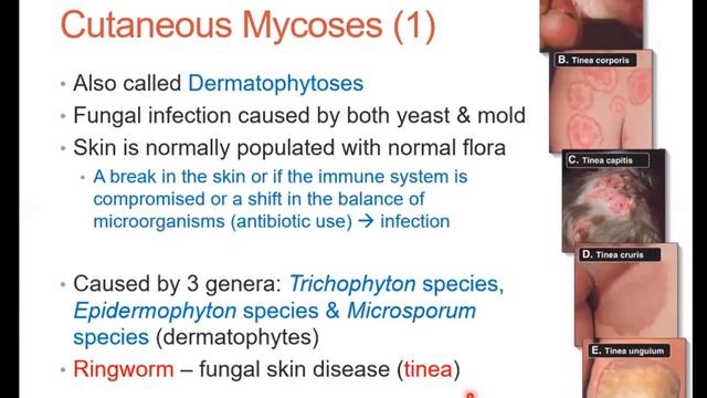 Microbiology Lecture 15: Mycology - Medically Important Fungi 🦠 смотреть онлайн