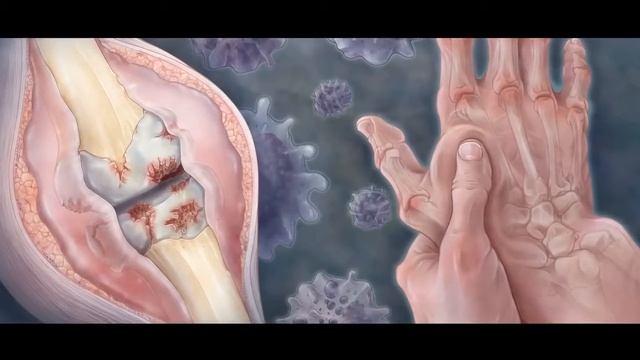 FOHOW  Биоэнергомасажер БЭМ (Рекламный ролик)