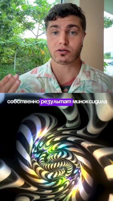 МИНОКСИДИЛ - МОЙ РОСТ БОРОДЫ ЗА 6 МЕСЯЦЕВ | КАК ОТРАСТИТЬ БОРОДУ? 🅰 #андрей_арбенин
