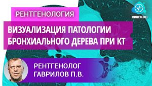 Рентгенолог Гаврилов П.В.: Визуализация патологии бронхиального дерева при компьютерной томографии