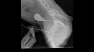 Мочекаменная болезнь струвитного типа