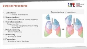 Surgical management of chronic pulmonary aspergillosis (CPA)