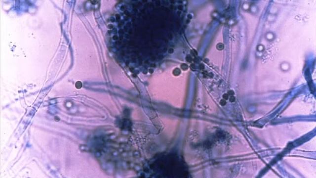 All About Allergy Slideshow - Aspergillus fumigatus 12 of 29