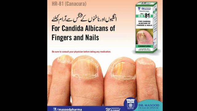 Nail fungusCandida albicansHR81DrHiraMasood pharmaceutical