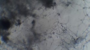 Trichoderma viride - ТРИХОДЕРМА ВЕРИДЕ - Petri lėkštutė, didinimas ~150x - Увеличение
