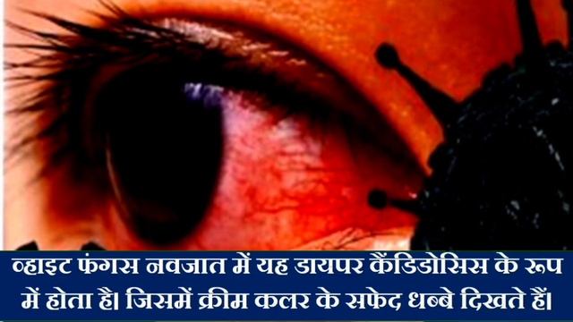 White Fungus | White Fungus Kya Hai | White Fungus ke Lakshan | What is White Fungus смотреть онлайн