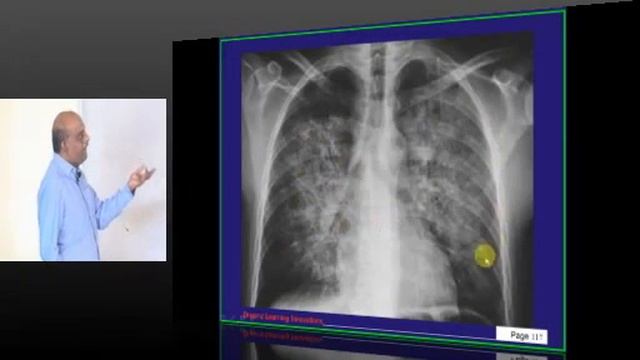 NEET PG Test 1540 Lec 01 смотреть онлайн