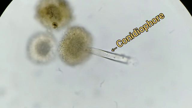 Aspergillus niger смотреть онлайн