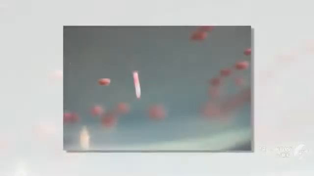 Saccharomyces cerevisiae - fungi kingdom смотреть онлайн