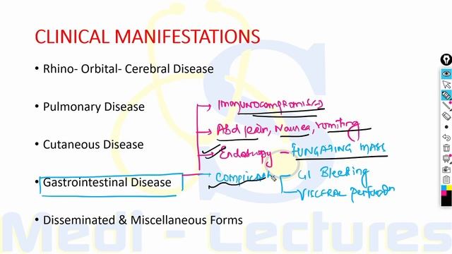 MUCORMYCOSIS | Black Fungus | Causes | Pathogenesis | Treatment | Harrison смотреть онлайн