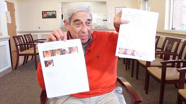 ULECERATIVE COLITIS: These Three Items Can Save Your Colon! Why Everyone Should Take Them